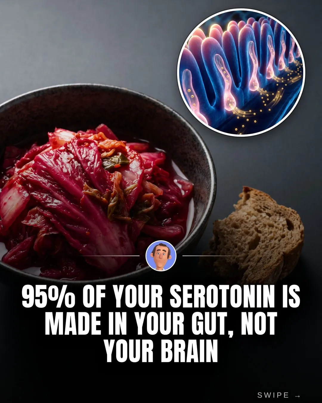 Första bilden: en skål kimchi bredvid en bit surdegsbröd och en närbild på tarmens insida, under rubriken att 95 procent av serotoninet bildas i tarmen och inte i hjärnan